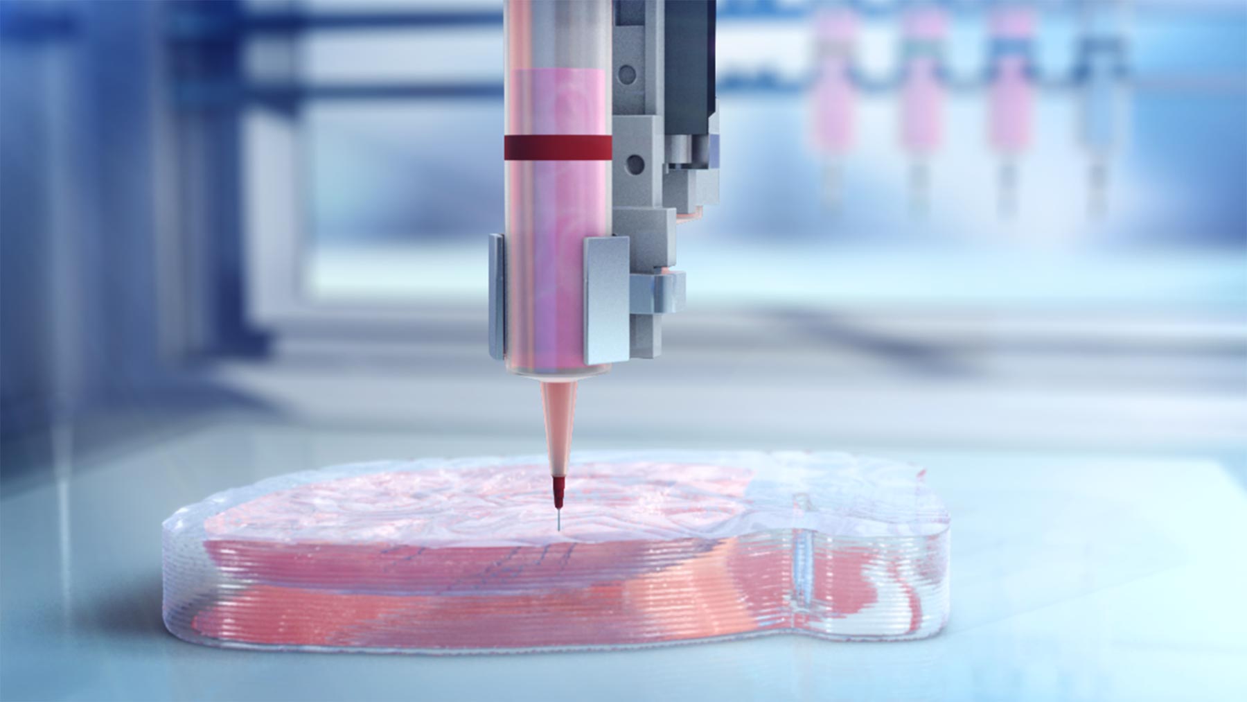 Bioprinting Human Hearts Bioprinting